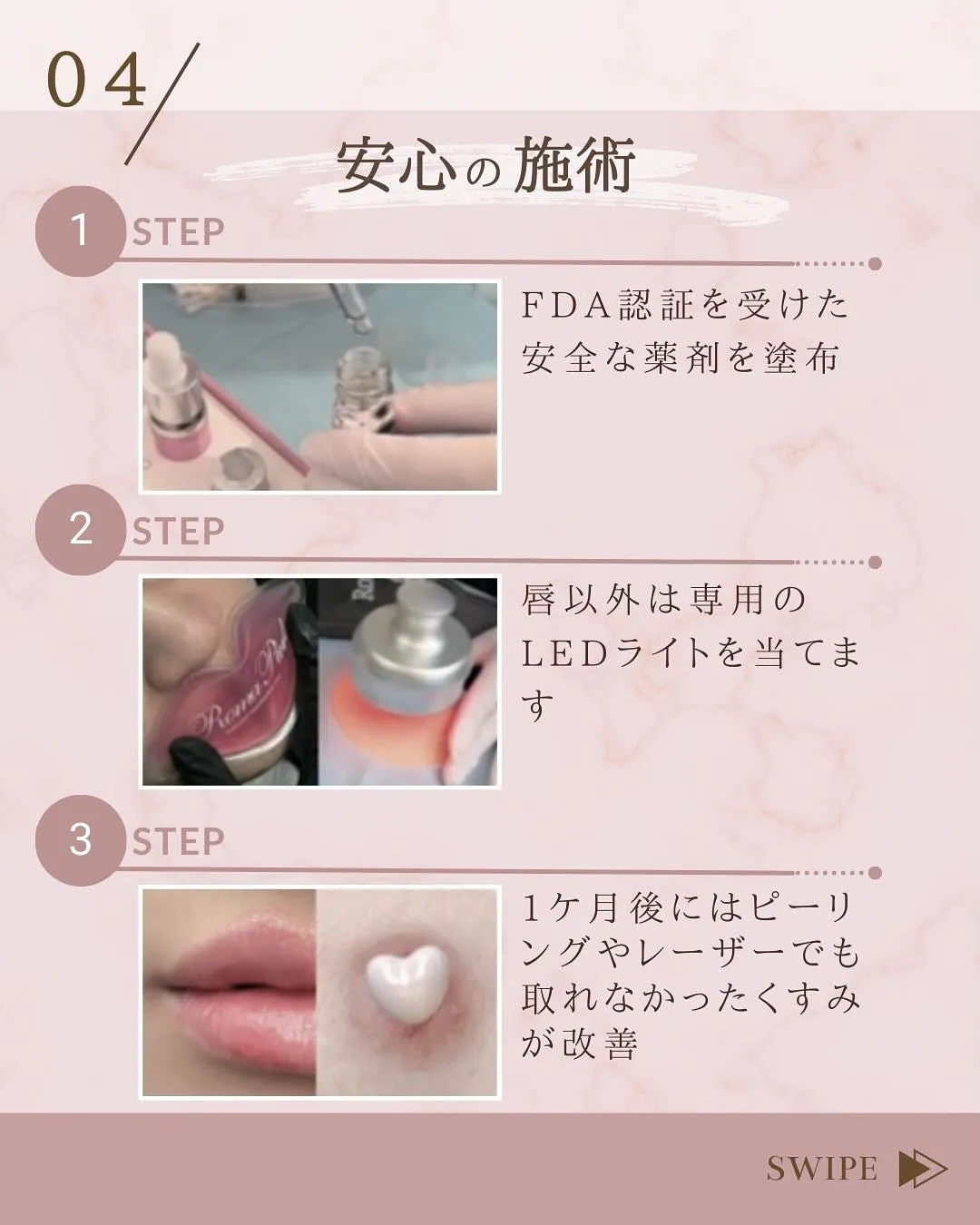 #ローマピンク 📢