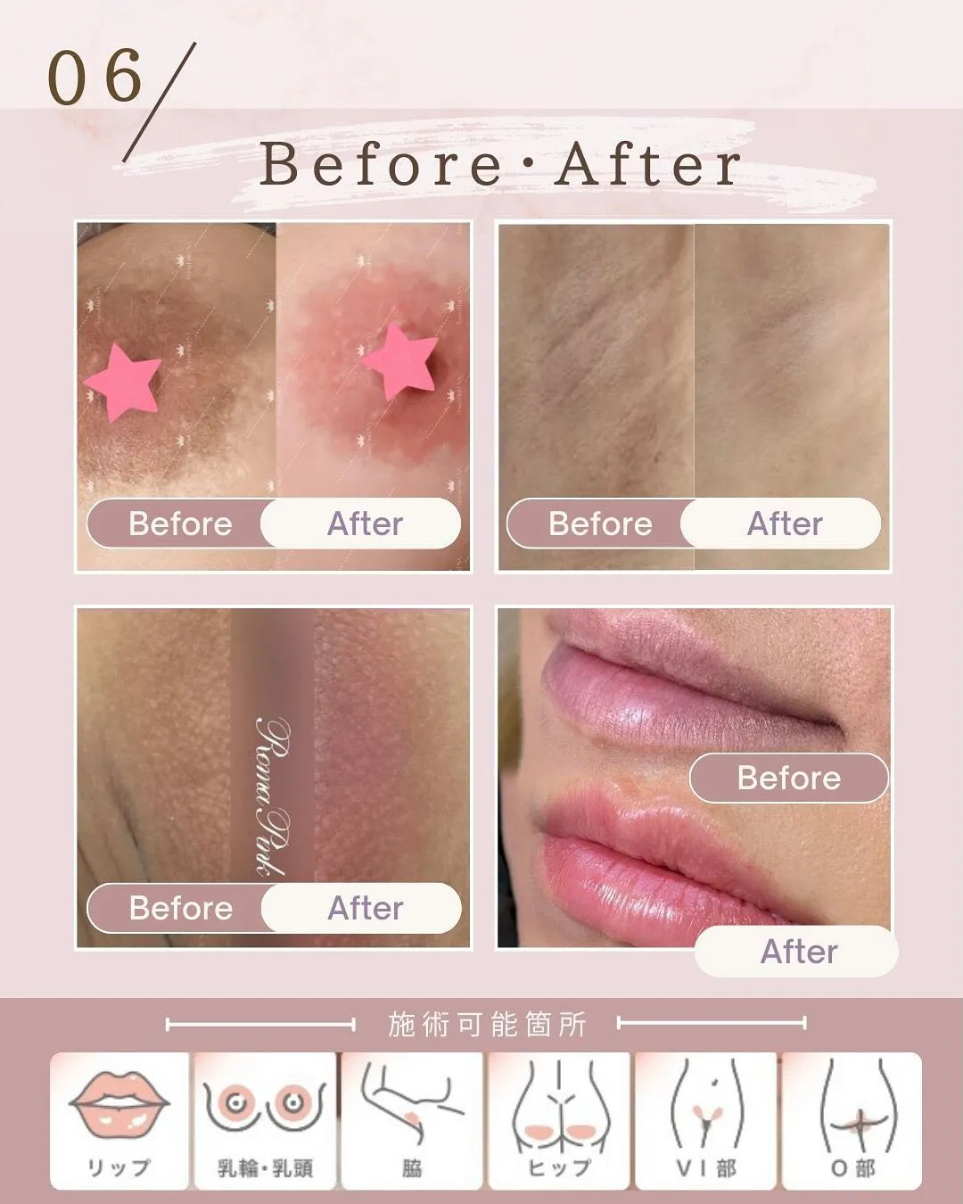 #ローマピンク 📢