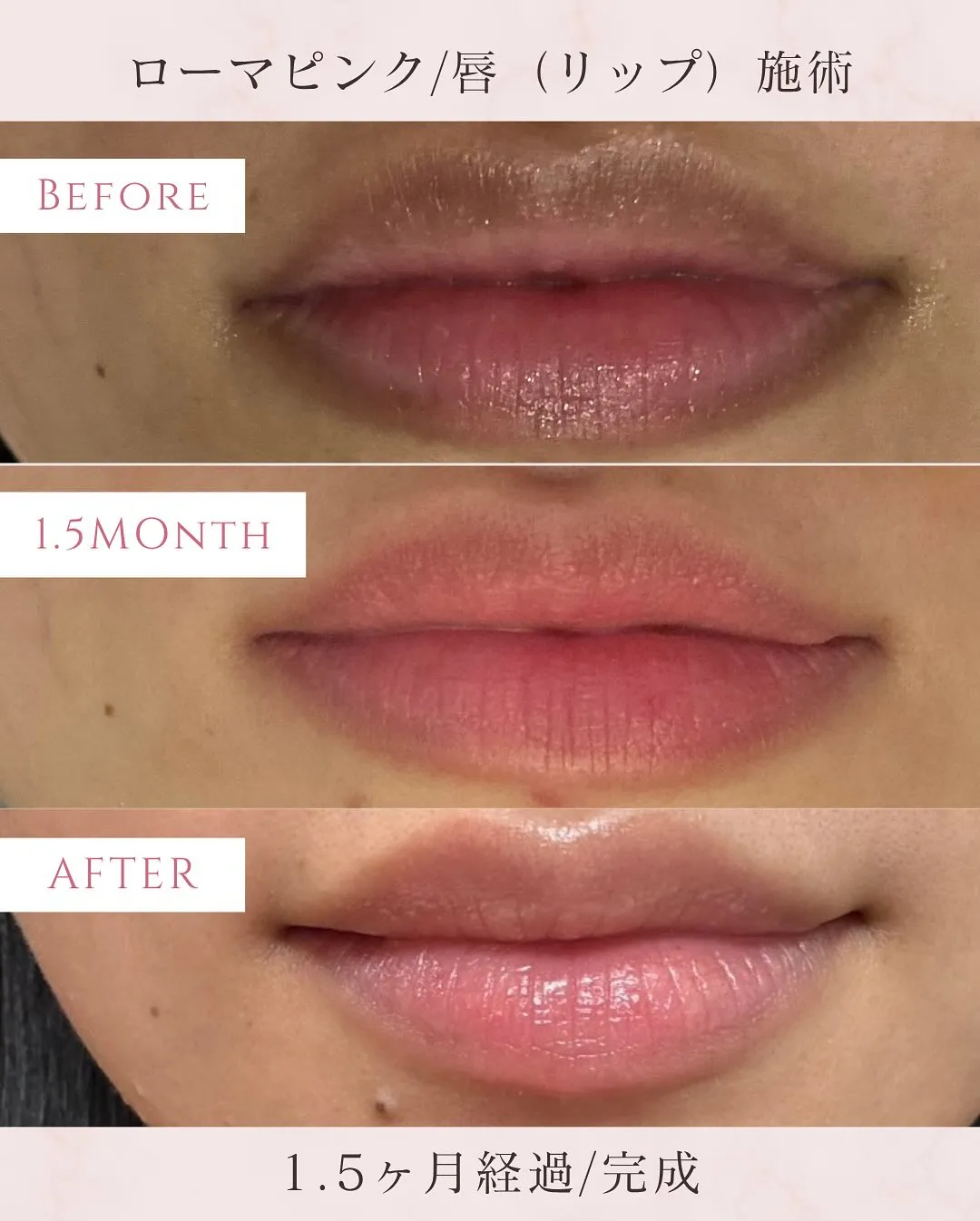 #ローマピンク 📢