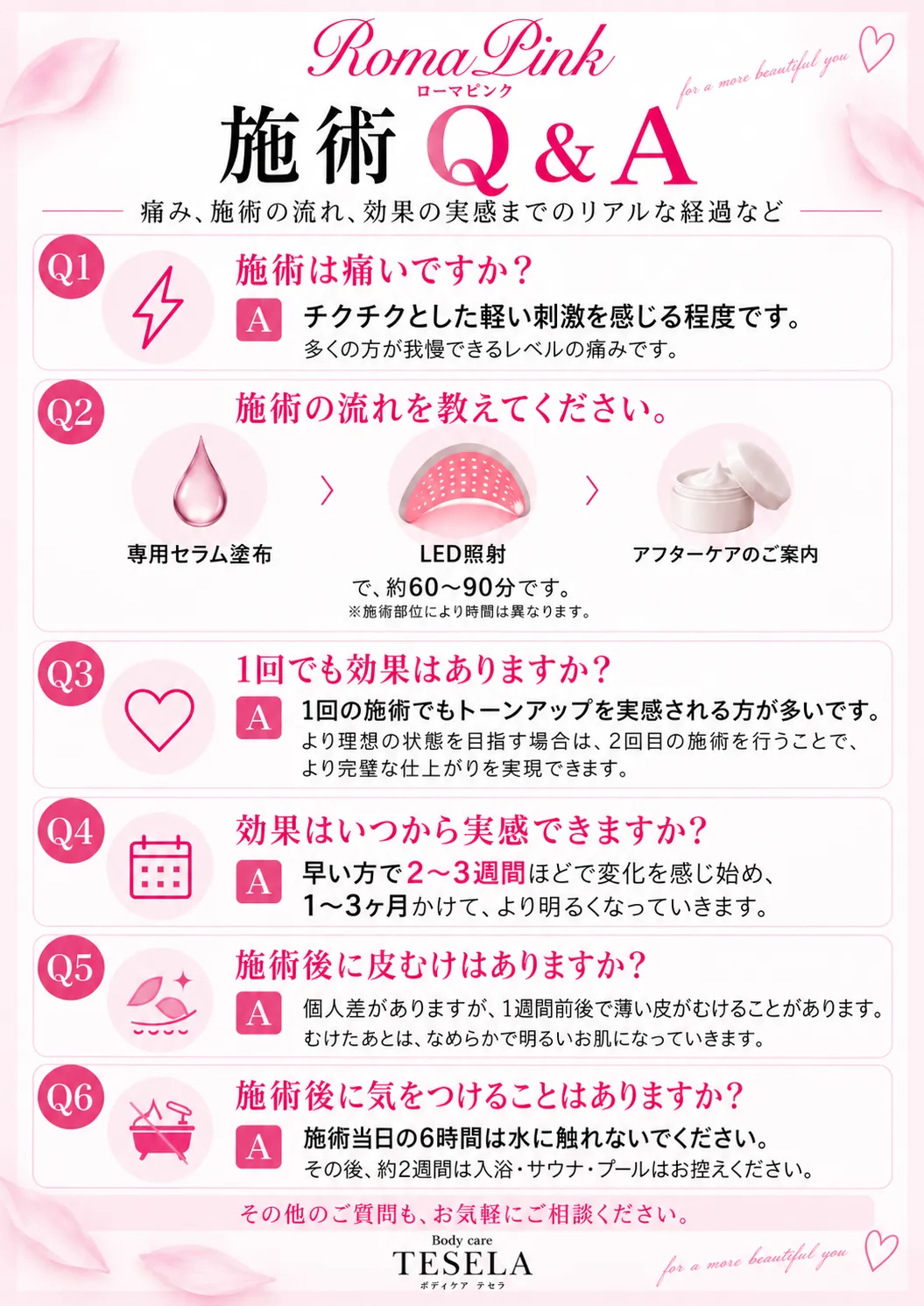 ローマピンク名古屋|施術の流れ・効果・料金をご紹介
